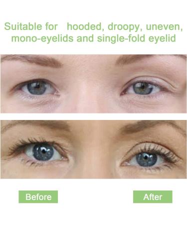 Invisible Eyelid Lift Strips 480pcs Set - Self-Adhesive Eye Lid Correction Tape for Saggy, Hooded, Droopy Eyelids - Skin Tone, One-Sided Sticky - Sizes S & L - Buy Online on SooperMarket.com