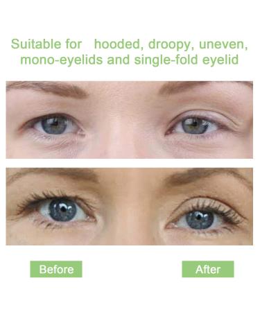 288pcs 5mm Invisible Eyelid Tapes - Self-Adhesive Lift Strips for Perfect Eyelids | 24-Hour Hold Beauty Tools - Buy Online on SooperMarket.com