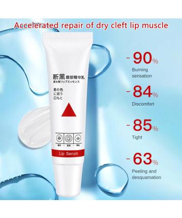 Lip Whitening Balm for Dark Lips - 15ml Lip Brightening Serum for Men & Women - Repair & Revitalize Darkened Lips - Buy Online on SooperMarket.com