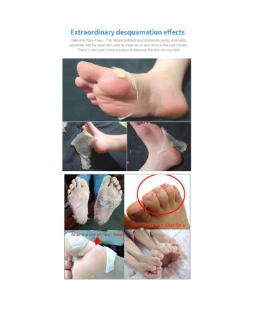 Onkessy Foot Peel Mask - Exfoliating Dead Skin Feet Repair Treatment - For Men and Women - Pedicure Spa - 1 Pair - Buy Online on SooperMarket.com