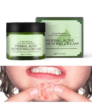 Acne Cream Moisturiser Face Cream Spot Cream Mens Moisturiser Tea Tree Cream Spot Cream For Acne Cream Moisturiser for Women Men Teenagers Dilute Face Prone Spot Marks Balance Facial Oil Cream