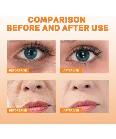 Dajidafu Portable Eye Dark Circle Spray Anti-age Anti-wrinkle Mist Sprays Moisturizing Hydrating Sprayer Wrinkle Remover Skin Care - Buy Online on SooperMarket.com