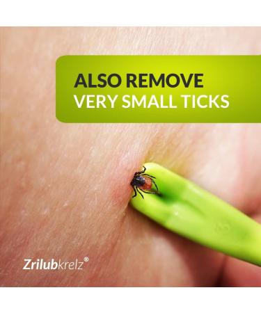 Zrilubkrelz Tick Tongs Tick Remover Set - Premium Tick Protection for Dogs, Cats, Horses - 3 Tick Levers Included - Buy Online on SooperMarket.com
