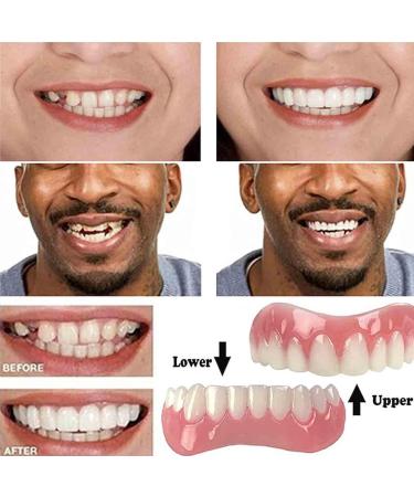 Buy Dentures & Cosmetic Veneers - Temporary Prosthesis & Silicone Tooth Plates for Men & Women - 2PCs International Shipping - Buy Online on SooperMarket.com