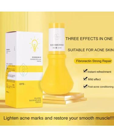 Gentle Acne Serum for Face Acne Treatment Essence Relief Pimple Pigmentation Blackhead Brighten Shrink Smooth Skin Redness Relief Face Acne Spot Treatment Repair Skin for Acne Skin - Buy Online on SooperMarket.com