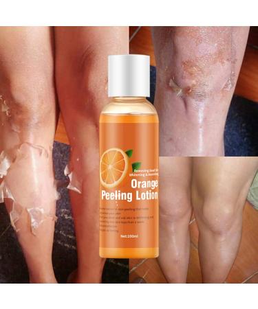 HUSHUI Orange Peeling Lotion Skin Whitening Body Lotion Gentle Peeling Gel Body Care
