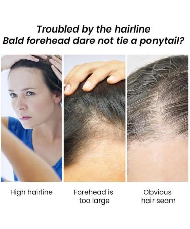 Magical Fluffy Thin Hair Powder Hair Coverage Touch Up Hair Powder Root Cover Up for Thinning Hair 4g 2pcs - Buy Online on SooperMarket.com