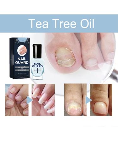 HOPASRISEE Onyxoguard Nail Growth and Repair Serum Onyxoguard Serum Nail Strengthener Nail Growth Serum Nail Growth and Strengthener Nail Serum for Strength and Growth (1) - Buy Online on SooperMarket.com