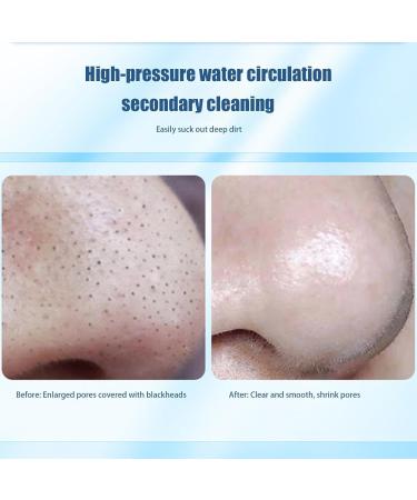 Visiblurry Electric Black Head Remover - Electric Extractor Tool Adjustable Rechargeable Remover with 6 Suction for Skincare for Women and Men - Buy Online on SooperMarket.com