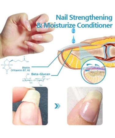 Onyxoguard Nail Growth And Repair Serum Onyxoguard Serum Nail Growth And Strengthener Nail Growth And Repair Serum Nail Growth Polish Nail Strengthener For Thin Nails And Growth (2PCS) - Buy Online on SooperMarket.com
