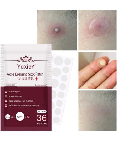 Acne Dressing Spot Patch Acne Paste Transparent Pimple Patch Breathable Painless Acne Treatment Gel Patch Skin Care Absorb Pus Rapid Healing Effective Antibacterial Protection 36 Patches - Buy Online on SooperMarket.com