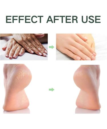 Foot Cream for Cracked Heels and Dry Skin Feet Hard Skin Remover Foot Moisturiser Callus Remover for Feet Nourishes Feet & Hand Foot Care Cream to Improve Elasticity & Smoothen Skin - Buy Online on SooperMarket.com