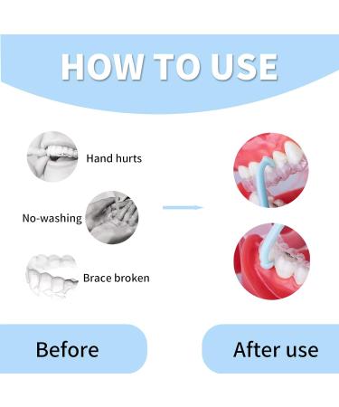 4PCS YAFIYG Clear Aligner Remover Tool - Hygienic Grabber for Aligner Case/Dental Carry Case - Buy Online on SooperMarket.com