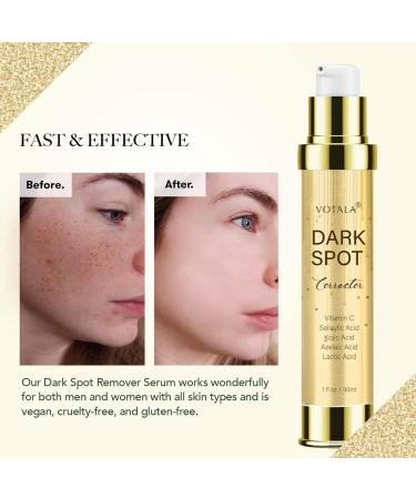 Dark Spot Corrector for Face & Body | Age & Sun Spots Remover with Kojic Acid & Vitamin C | All Skin Types | 1 fl oz - Buy Online on SooperMarket.com