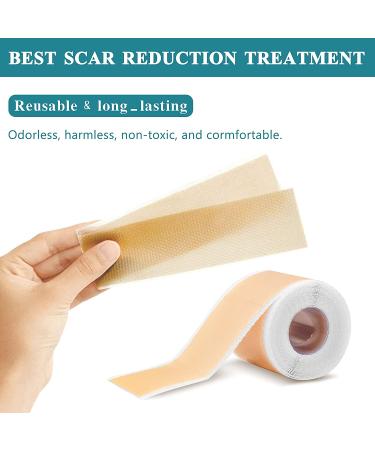 Medical Grade Silicone Scar Tape Roll (1.6 x 60) for Scar Removal - Professional Silicone Strips for Surgery, C-Section, Acne, Burn and Keloid - Safe & Reusable - 1.5M - Buy Online on SooperMarket.com