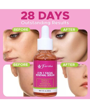 4 in 1 Facial Renewal Serum - Vitamin C E Hyaluronic Acid & Niacinamide | Ultra Regenerating Treatment for Radiant Skin - Buy Online on SooperMarket.com