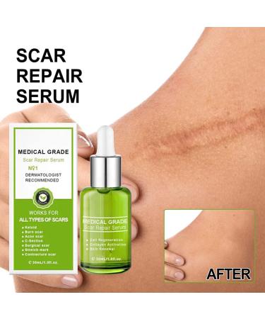 Dajidafu Women Belly Stretch Mark Body Acne Scars Removal Girls Repair Essence Anti-aging Beauty Supplies 30ml - Buy Online on SooperMarket.com