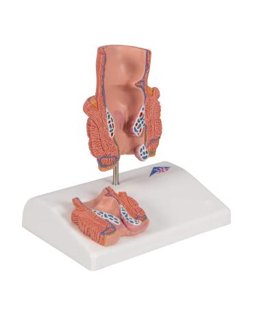 3B Scientific K27 Hemorrhoid Model 5.5-Inchx3.9-Inchx5.5-Inch - Buy Online on SooperMarket.com
