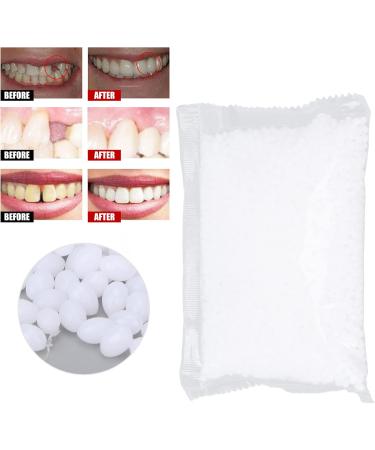 Temporary Dental Repairs - 100g Thermal Fitting Beads for False Teeth & Tooth Filling - Perfect for Halloween Parties - Buy Online on SooperMarket.com
