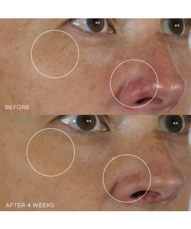 Tatcha Silk Serum 30ml | Wrinkle-Smoothing Retinol Alternative - Buy Online on SooperMarket.com