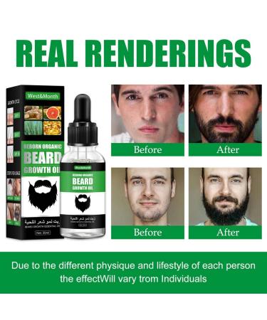 Buy 2PCs Beard Growth Oil | Biotin Bart l for Stimulating Beard Growth | International Shipping - Buy Online on SooperMarket.com