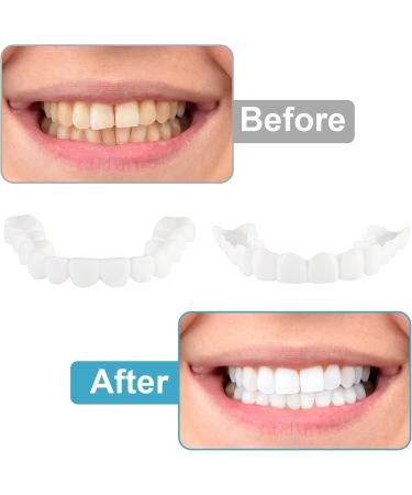 2 PCS Fake Dentures Teeth for Women and Men - Temporary Dental Veneers for Natural Restoration and Comfort - Protect Teeth & Regain Confident Smile - Natural Shade-n2 - Buy Online on SooperMarket.com