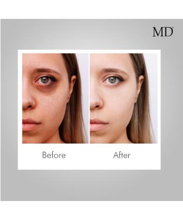 MD Factor Ultimate Anti-Aging Cream | Anti-Wrinkle & Skin Brightening | Peptides for Hydration Collagen Boost & Skin Whitening - Shop Internationally - Buy Online on SooperMarket.com