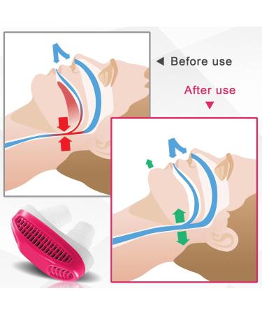 Anti Snoring Nasal Air Purifier - Sleep Apnea Device for Men and Women - Stop Snoring and Improve Sleep Quality - Red - Buy Online on SooperMarket.com