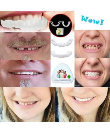 Buy Flipped Warm Veneers Teeth Set - Top & Bottom Artificial Braces for Men & Women | Temporary False Teeth with Box - International Shipping Available - Buy Online on SooperMarket.com