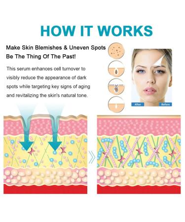 Fast-Acting Dark Spot Remover for Face & Body | Hyperpigmentation & Melasma Corrector | Even Skin Tone | Age Spot Treatment for Men & Women - Buy Online on SooperMarket.com