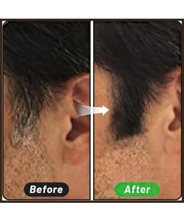 MIELIKKI Hairline Concealer Powder - Instantly Conceal Hair Loss & Thin Hair for Men & Women Stain-Proof Formula Brown 03 - Buy Online on SooperMarket.com