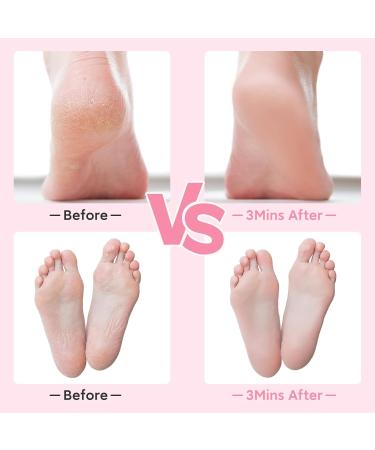 Subay Glass Foot File Callus Remover for Feet Foot Scrubber for Dead Skin Dry Cracked Feet Portable Pedicure Tools for Wet and Dry Feet - Buy Online on SooperMarket.com