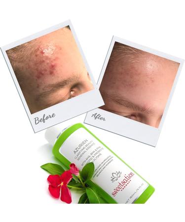Sweetsation Therapy YUNASENCE AZURIEN Clarifying Beauty Renewal Essence 6oz - Exfoliate & Renew with 7 AHA+BHA+PHA - International Shipping Available - Buy Online on SooperMarket.com
