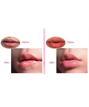 CCbeauty Collagen Lip, Eye, Nose Blackhead Mask 20-Pack Mix Pack - Hydrating, Moisturizing, Anti-Chapped Pads for Dry Lips - Remove Dead Skin, Essence Care Gel - Buy Online on SooperMarket.com