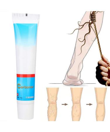 Varicose Vein Treatment Cream - Reduce Inflammation, Improve Circulation | Vein Lotion for Legs & Body - Buy Online on SooperMarket.com