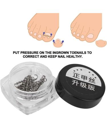 Ingrown Toe Wire Fixer 2 Box Fixer Toenail Correction Corrector Lifter Tool Nail Ingrowing Pedicure Care with 6 Sizes for Nail Toe Straighteners Recover Foot Care Men and Women - Buy Online on SooperMarket.com