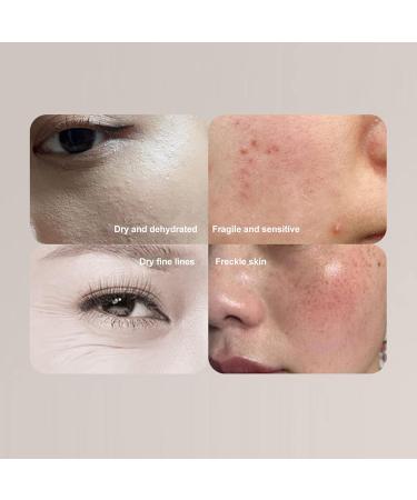 Smart Analyse Skin Water Oil Analyzer with 3 Color Indicator Light Portable Facial Analyzer USB Facial Moisture Meter for Beauty Salon - Buy Online on SooperMarket.com