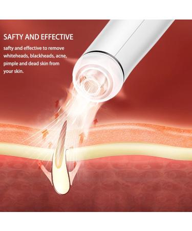 Glamne Blackhead Remover Vacuum | Electric Rechargeable Pore Cleaner for Men and Women - Pink - Buy Online on SooperMarket.com
