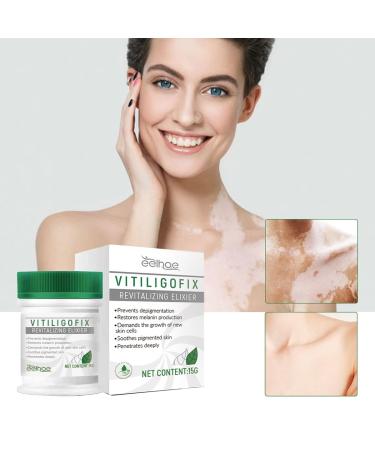 Vitiligo Treatment Cream | Natural White Spot Remover | Leukoplakia Relief | 2PCS - Buy Online on SooperMarket.com