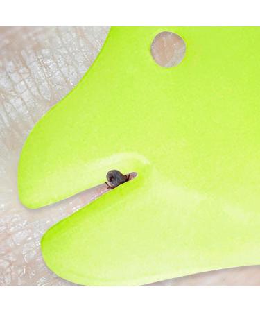 MYDAISY Tick Remover Card with Magnifying Glass - Perfect for Removing Ticks - Ideal for Outdoor Activities - Buy Online on SooperMarket.com