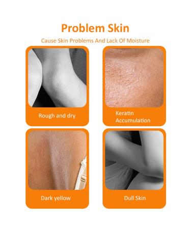 Korean Orange Peel Lotion- Whitening Peel Gel Dead Skin Remover Exfoliator (1 Bottle) - Buy Online on SooperMarket.com