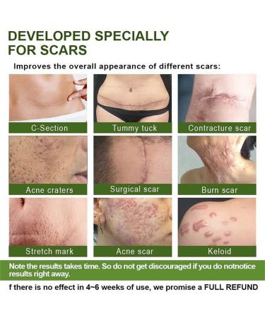 Goopgen Advanced Scar Repair Serum 30ML - Nature Scar Treatment - Scar Removal Serum for All Types of Scars (1PC) - Buy Online on SooperMarket.com