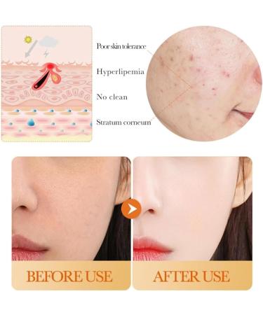 Turmeric Face Toner Dark Spots Skin Toner for Face Turmeric Hydrating Face Toner for Dry Skin Turmeric Oil Toner Serum Reduce Dark Spots & Acne Toner Moisturiser Day & Night Use 150 ml - Buy Online on SooperMarket.com