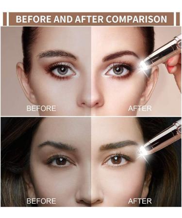 SiKii Eyebrow Hair Remover - Painless Precision Trimmer with LED Light (Rose Gold) | Facial Hair Removal for Women and Men - Buy Online on SooperMarket.com