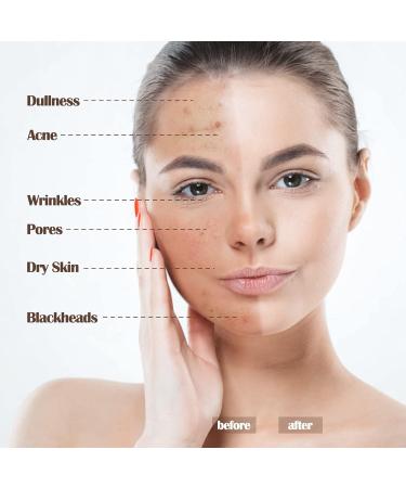 Aquapurity Phoera Full Coverage Foundation 30ml - 103 Warm Peach | Soft Matte Oil Control Concealer for Flawless & Long Lasting Results - Buy Online on SooperMarket.com