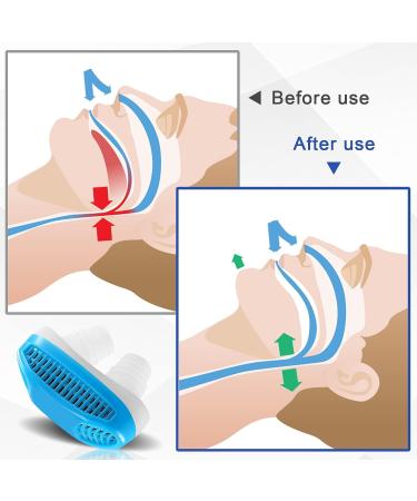 2-in-1 Anti Snoring Nose Air Purifier | Nasal Vents for CPAP Users | Stop Snoring Sleep Aid for Men and Women - Blue - Buy Online on SooperMarket.com