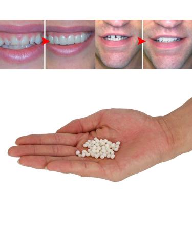 2pcs 50g False Teeth Solid Glue Kit - Temporary Tooth Replacement & Repair Adhesive - Buy Online on SooperMarket.com