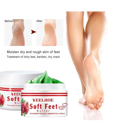 Regenerating Foot Cream for Firing (Rhagaden) Treatment - Heal Cracked Skin on Hands Elbows & Feet | International Shipping Available - Buy Online on SooperMarket.com