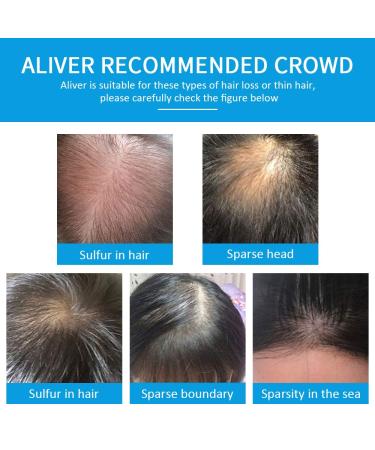 Moulis Hair Fibers with Spray Applicator - Thicker Fuller Hair in 15 Seconds - Light Brown - 2-in-1 Hair Building Kit for Men and Women - Buy Online on SooperMarket.com