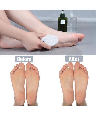 Pumice Stone 2 Pcs for Feet/Hands - Natural Lava Callus Remover and Foot Scrubber - MAYKI White Round Shape - Buy Online on SooperMarket.com